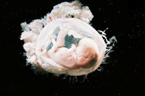 تحقیق بررسی سقط جنین