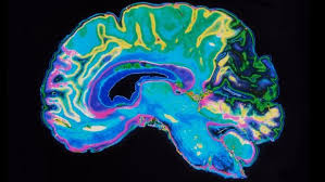 تحقیق تصويربرداري از مغز در هنگام درد