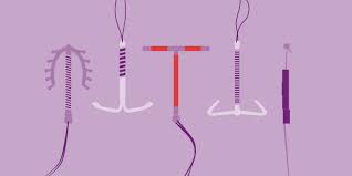تحقیق IUD روشي براي جلوگيري از حاملگي